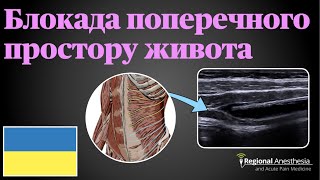 Ultrasound Guided Fascia Iliaca Block [upl. by Harv]