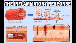 THE INFLAMMATORY RESPONSE [upl. by Spenser]