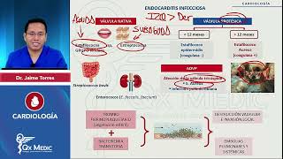 CARDIOLOGÍA Endocarditis infecciosa Endocarditis infecciosa mp4 [upl. by Ilana]