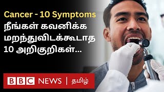 Cancer 10 Symptoms இதை சீக்கிரம் கவனிச்சிட்டா Treatment மூலம் குணப்படுத்திவிடலாம் [upl. by Zenas]