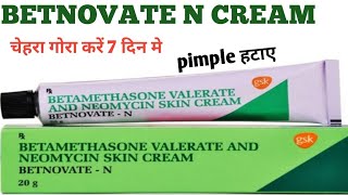 Betnovate N Cream  Betamethasone Valerate And Neomycin Skin Cream Review [upl. by Winslow]