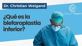 Blefaroplastia inferior en Madrid  DrWeigand  Experto [upl. by Brit]