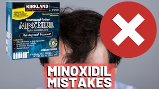 5 BIGGEST MISTAKES When Using Minoxidil REVEALED [upl. by Aistek306]