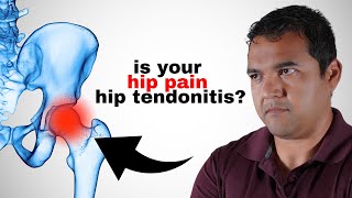 Identify Hip Tendonitis 3 Tests You Can Perform at Home [upl. by Dorelia]