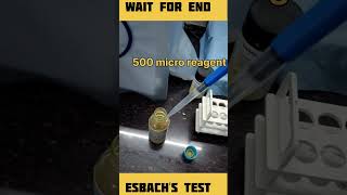 how to test urine protein ESBACHS test medical pathology viral popular subscribe ytshorts [upl. by Hun]