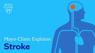 Mayo Clinic Explains Strokes [upl. by Eniarrol]