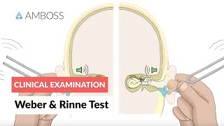 Weber and Rinne Test  Clinical Examination [upl. by Ycnalc521]