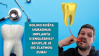 🦷Koliko košta ugradnja implanta u Engleskoj Skuplje je od zlatnog zuba [upl. by Aneelad]