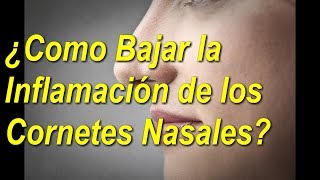 5 👀TRATAMIENTOS NATURALES para los 👃CORNETES de la NARIZ  Al 👉FINAL QUEDARAS 😲SORPRENDIDO [upl. by Christina]