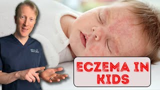 How to treat Eczema in Babies amp Children Dermatology Doctor explains [upl. by Brenn]