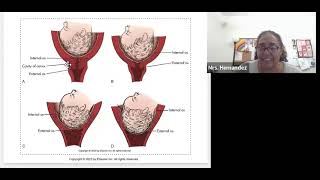 Chapter 13 Labor and Birth Process [upl. by Nerej]