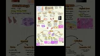 Breast pathology notes Breast cancer Short note  Fibroadenoma of breast [upl. by Otilopih474]