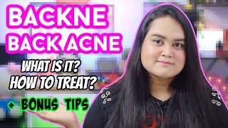 BACK ACNE  BACKNE  WHAT WHY TREATMENT amp TIPS  MAITRAYEE HALDER [upl. by Killigrew]