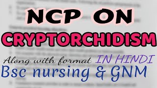 Nursing care plan on CRYPTORCHIDISM child health nursingmedical surgical nursingGNMBSC [upl. by Center]