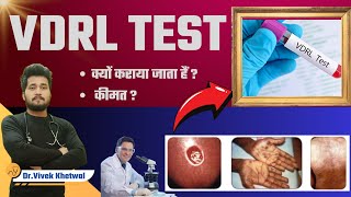 VDRL Test l VDRL Test In Hindi l Dr Vivek Khetwal vdrl youtube [upl. by Korman]