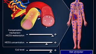 Chronic respiratory acidosis [upl. by Atilemrac110]