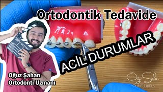 Ortodontik Tedavide Acil Durumlar  Telim çıktı ne yapmalıyım  DrOğuz Şahan [upl. by Yelrahc498]