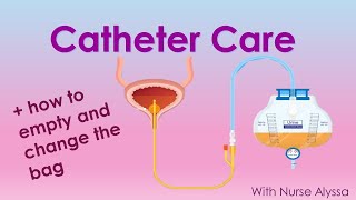 Catheter Care  how to change and clean the bag [upl. by Doowrehs]