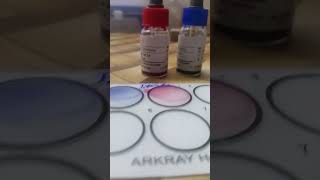 Widal Test 🩸 sorts shorts shortvideo science pathology lab lablife medicallab viralvideo [upl. by Rheta]