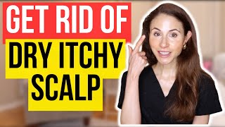 Get Rid Of Dry Itchy Scalp FAST [upl. by Cuttie335]