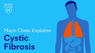 Mayo Clinic Explains Cystic Fibrosis [upl. by Almeria]