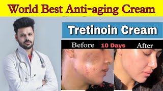 Tretinoin 0025 cream review  Retino A 0025cream Review  tretinoin cream 0025 before and after [upl. by Hardner]