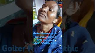 Goitre Homeopathic Treatment Part 2 Improved 70 [upl. by Nart726]