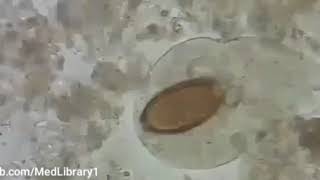 Trichuris trichiura تريكيرا تركيرا [upl. by Eislrahc]