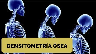 ¿Cómo se hace una densitometría ósea  Densitometría ósea interpretación [upl. by Crandell]