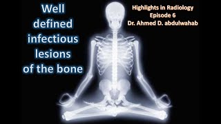 Infections lytic bone lesions Highlights in Radiology Episode 6 [upl. by Enytsuj]