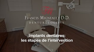 Implants dentaires étapes de lintervention par le denturologiste Francis Migneault 450 4445051 [upl. by Willner]