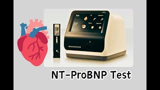 NTProBNP test  Cardiac Marker STANDARD™ F [upl. by Jonathan]