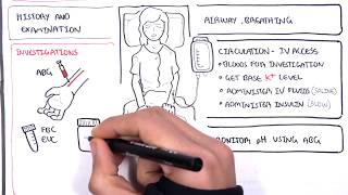 Diabetic Ketoacidosis Diabetes Type I Management Summary [upl. by Rutter]