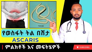 Ethiopia  የወስፋት ትል በሽታ ምልክቶች እና መፍትሄዎች Ascaris [upl. by Lanette]