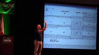 Understanding Ventricular Tachycardia [upl. by Aibos]