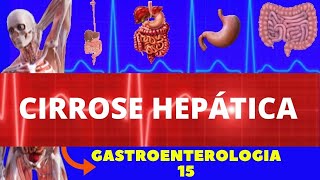 CIRROSE HEPÁTICA CAUSAS SINTOMAS DIAGNÓSTICO E TRATAMENTO  GASTROENTEROLOGIA [upl. by Anhaj]