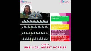 Ultrasound  Umbilical Artery Dopler  Dr Nina Navakumar  StudyULTRASOUND [upl. by Calva]