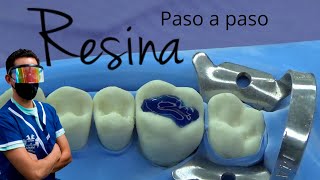 Como hacer una resina dental paso a paso [upl. by Kcerb65]