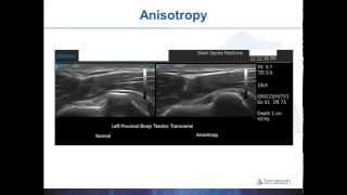 Terasons Introduction to MSK Ultrasound Guided Procedures with Dr Gruba Part 1 [upl. by Adnuhsed]