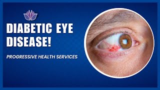 Diabetic Eye Disease  Progressive Health Services [upl. by Naryb84]