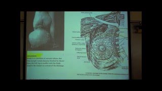 ANATOMY LYMPHATIC SYSTEM by Professor Fink [upl. by Luna]