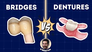 Treatment Planning Bridges vs Dentures  The Art and Science  PDP198 [upl. by Anatnom]