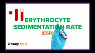 Erythrocyte Sedimentation Rate ESR Made Simple [upl. by Ibloc]