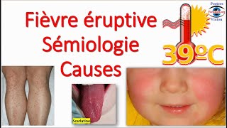 Fièvre éruptive Sémiologie Éruption erythemato maculo papuleuse vésiculeuse purpura Toxidermie [upl. by Ellyn]