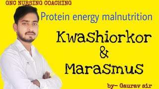 Protein energy malnutrition kwashiorkor and marasmus [upl. by Stesha462]