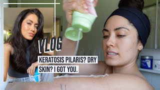 This is how I manage my Keratosis Pilaris KP and dry skin on my body  Melissa Alatorre [upl. by Anileh]