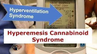 Hyperventilation Syndrome and Hyperemesis Cannabinoid Syndrome [upl. by Damon]