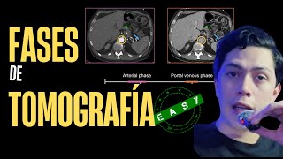 FASES DE TOMOGRAFÍA COMO NUNCA TE LAS HABÍAN EXPLICADO [upl. by Ayik]