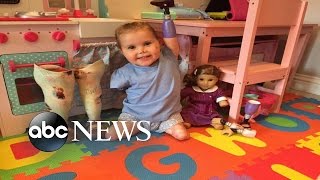 Toddler Without Limbs Gets a Doll That Looks Like Her [upl. by Nylasoj]