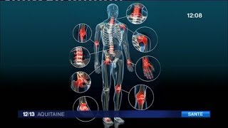 Quels solutions pour soulager les douleurs liées à larthrose [upl. by Auohp]